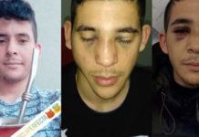 Studente pestato al Campus, individuati tre dei cinque aggressori