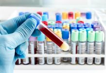 Sanità depressa, quel laboratorio chimico fantasma a Verbicaro