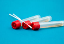 Belvedere M. Primo caso di positività al Coronavirus