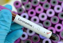 Il Tirreno Cosentino (Nuovamente) nella morsa del Sars-CoV2. Chiudono le scuole