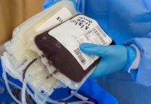 Covid19, Cura con il plasma, mortalità ridotta dal 15% al 6%