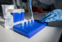 Positivo al Covid-19, Il sindaco “Esito tampone giunto dopo 15 giorni”