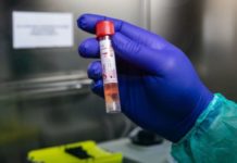 Nuovo Caso Positivo Nel Cosentino: Era Rientrato Dal Nord