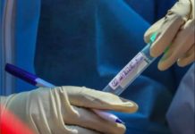 Coronavirus, focolaio di Palmi. Positivi altri 4 familiari degli infetti