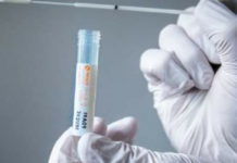 Tortora, Prosegue la campagna screening