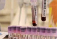 REGIONE CALABRIA ADERISCE A PROGETTO EUROPEO PER RACCOLTA PLASMA