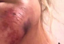 Violenza a Tortora, solidarietà da parte dell’unione delle Associazioni per la prof. Aggredita