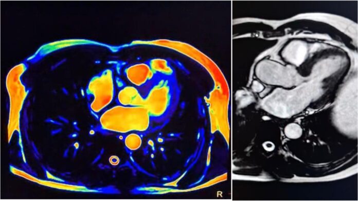 InCollage_20251113_143913915